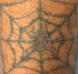 Détatouage au laser Enlighten. Florence MAGAND-NOWAK Dermatologue-Annecy 74